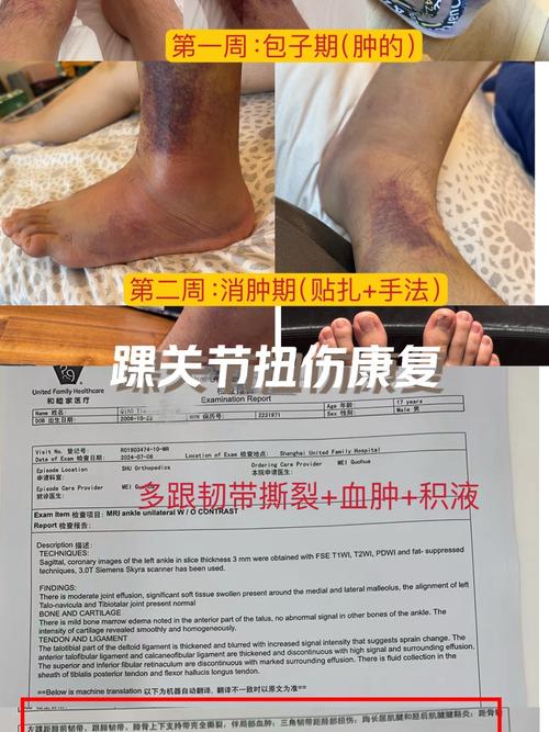 独行侠官方：莱夫利右脚出现肿胀和不适 7到10天后接受复查